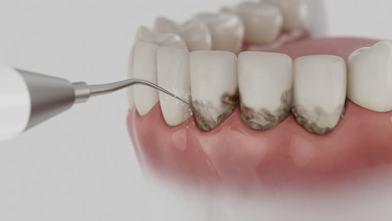 Reliable Dental Implants contractor in Morrisville, NC by Smile Center Dentistry